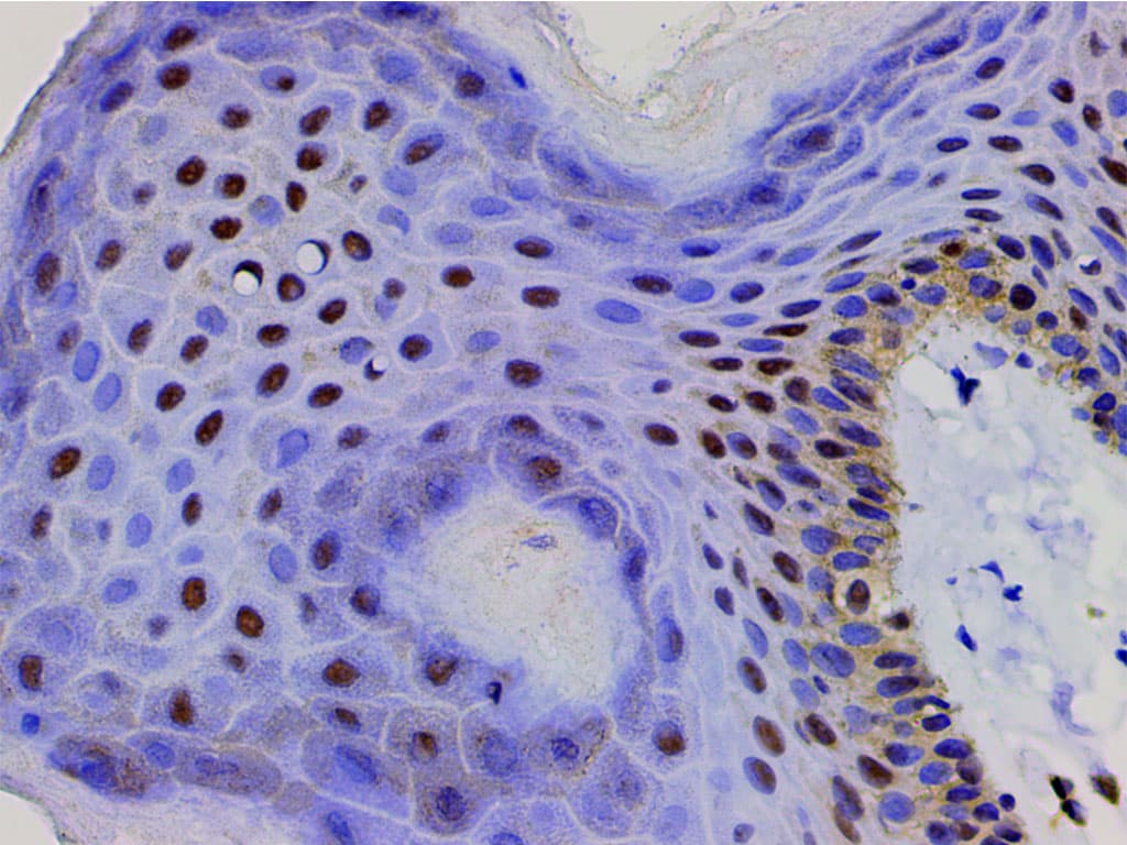 CFL1 / Cofilin Antibody (phospho-Ser3)