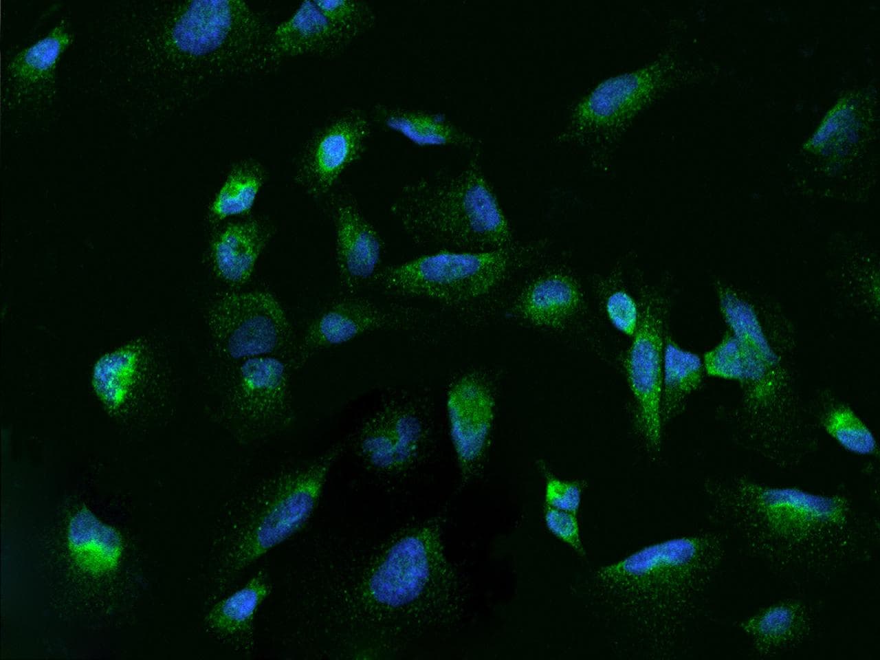 Polyclonal Rabbit anti-Human RAB7A / RAB7 Antibody (IHC, IF)