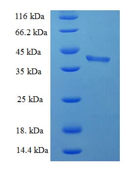 Human BID Protein (Recombinant His-SUMO)