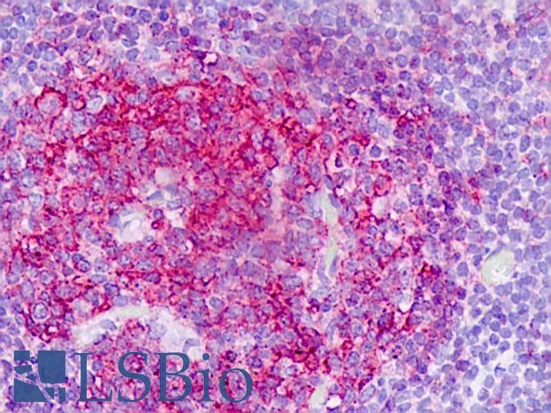 IHC-plus™ MOB1B / MOBKL1A Antibody (aa101-150)