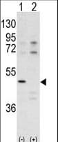 Polyclonal Rabbit anti-Human CDK10 Antibody (aa1-32, IHC, WB)
