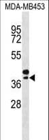 SEPP1 / Selenoprotein P Antibody (aa233-262)