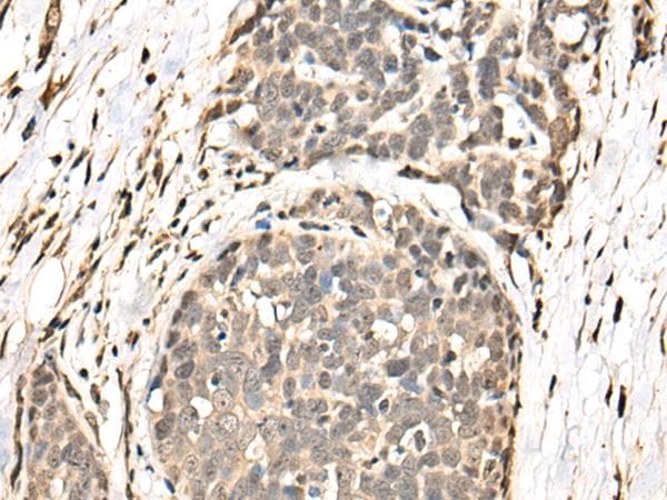 Polyclonal Rabbit anti-Human BATF Antibody (IHC)