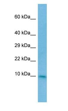 CC2D2A Antibody (aa20-69)