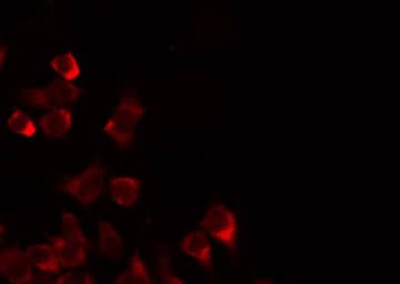 Polyclonal Rabbit anti-Human MRPL35 Antibody (IF, WB)