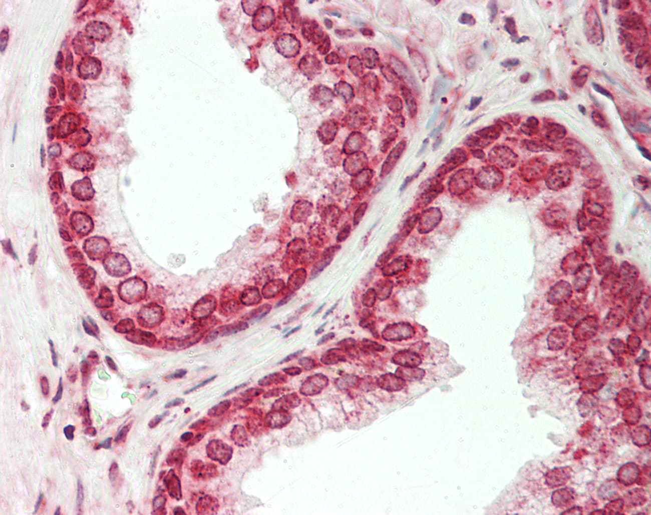 RARRES1 Antibody (aa126-175)