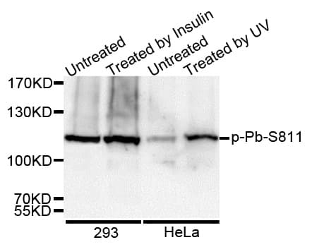 RB1 / Retinoblastoma / RB Antibody (phospho-Ser811)