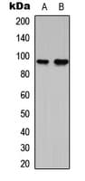 RBM5 / G15 Antibody (Internal)