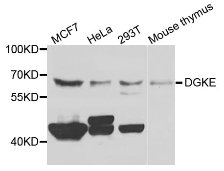 Polyclonal Rabbit anti-Human DGKE / DGK Epsilon Antibody (IHC, WB)