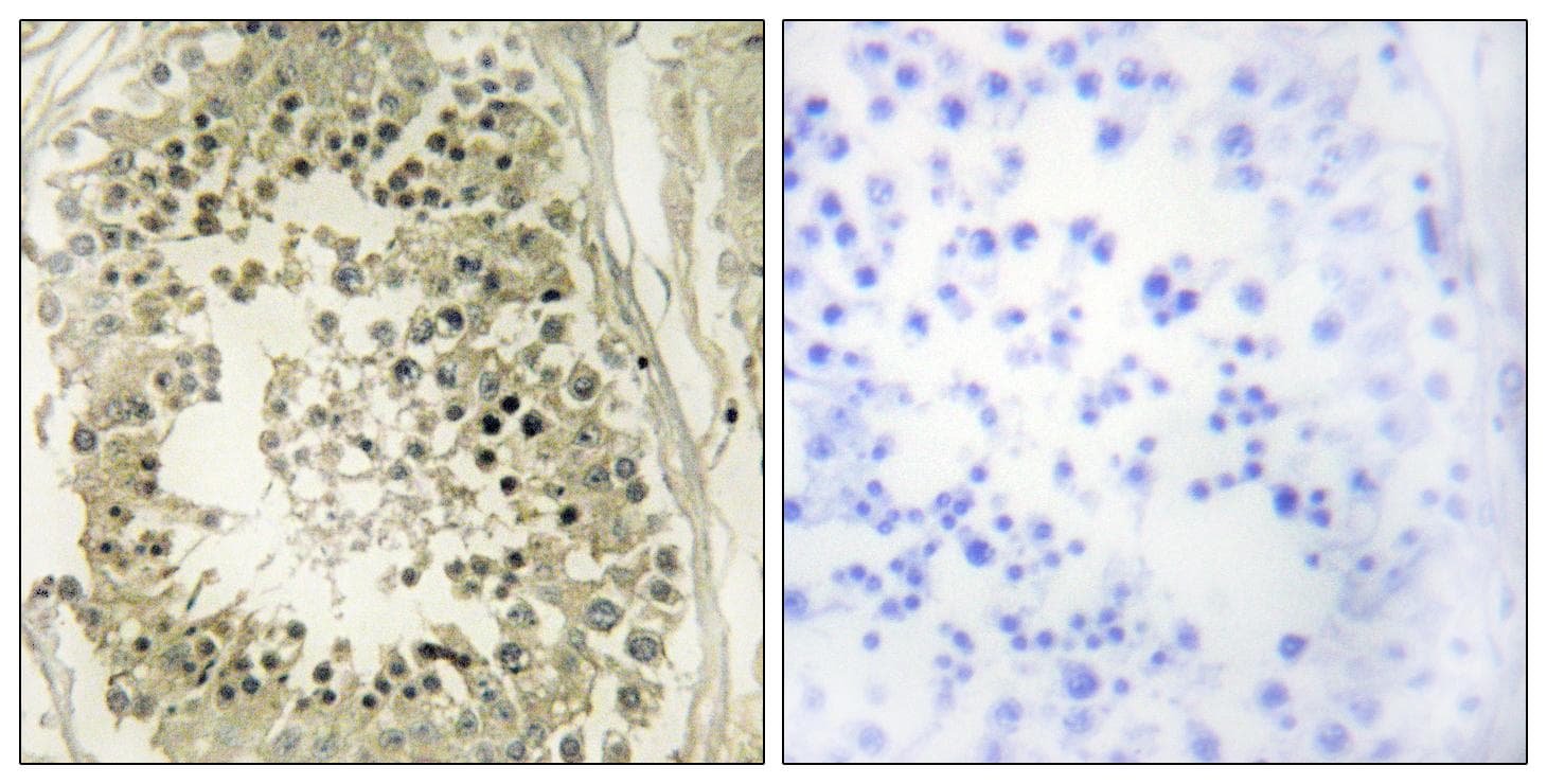 Polyclonal Rabbit anti-Human HRS / HGS Antibody (IHC, IF, WB)