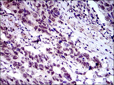 CFLAR / FLIP Antibody (aa100-251, clone 7A3D12)