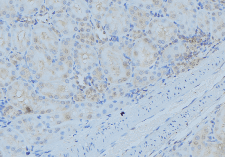 DYNC1I2 / IC2 Antibody