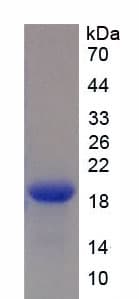 Human NPPB / BNP Protein (Recombinant His)
