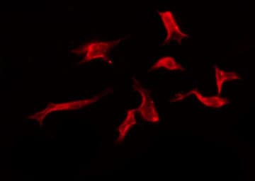 Polyclonal Rabbit anti-Human OR3A2 Antibody (IF, WB)