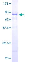 Human NUDC Protein (Recombinant GST)