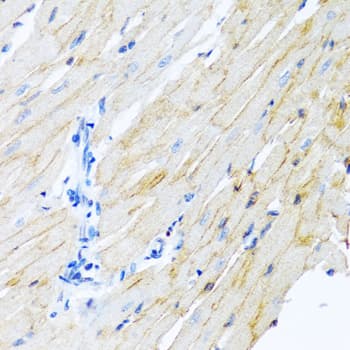 Polyclonal Rabbit anti-Human ADAM17 / TACE Antibody (IHC, WB)
