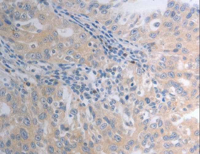 SHH / Sonic Hedgehog Antibody