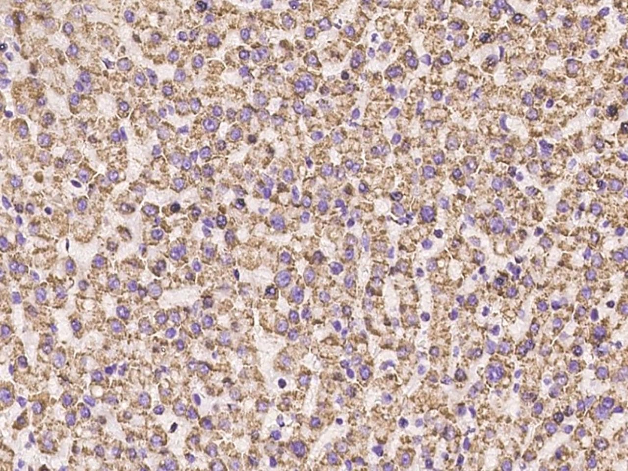 Polyclonal Rabbit anti-Human ADAM15 Antibody (IHC, IF)