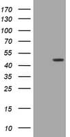 Monoclonal Mouse anti-Human BBOX1 / BBOX Antibody (clone OTI1D6, IHC, WB)