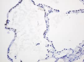 PCNA Antibody (clone OTI4G3)