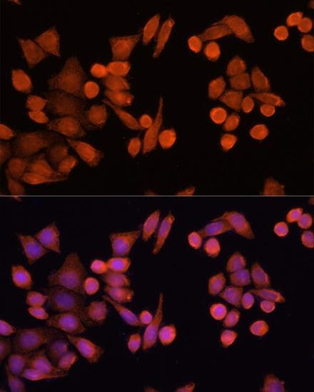 Polyclonal Rabbit anti-Human PLA2G4D Antibody (IF)