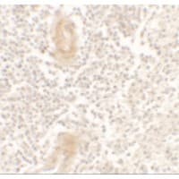 IL1F10 Antibody