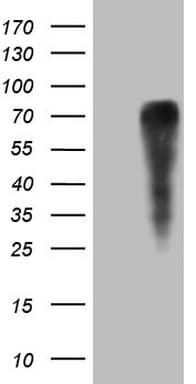 GRN / Granulin Antibody (aa327-593, clone OTI4B9)