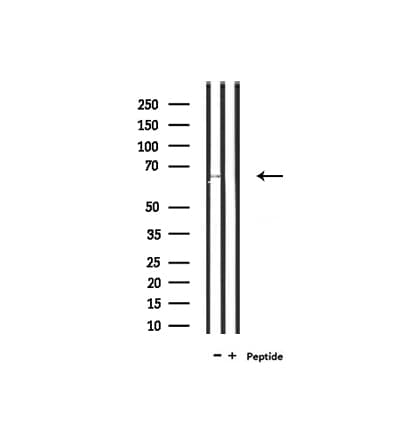SLC6A20 Antibody