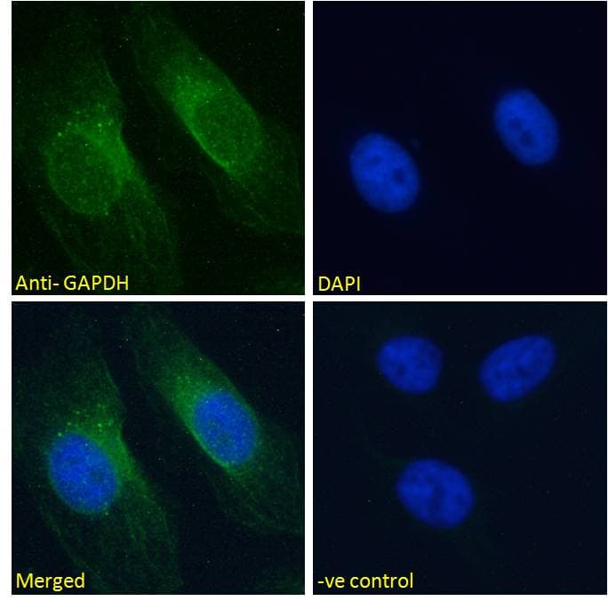 IHC-plus™ Polyclonal Goat anti-Human GAPDH Antibody (aa279-290, IHC, IF, WB)