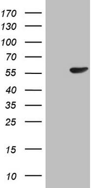 PELI1 / Pellino 1 Antibody (aa1-245, clone OTI2H3, Carrier-free)