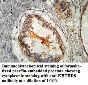 KBTBD8 Antibody (aa180-374)