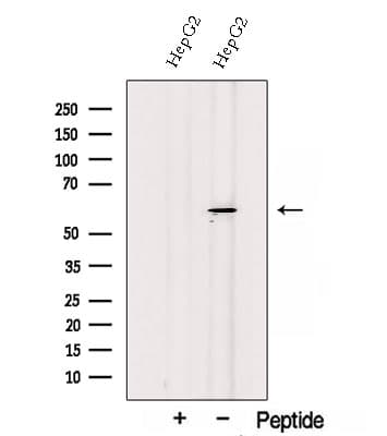 SESN3 Antibody (aa325-344)