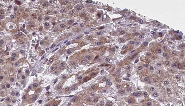 Polyclonal Rabbit anti-Human SLC16A4 Antibody (IHC, WB)