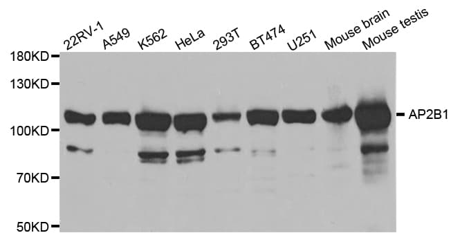 Polyclonal Rabbit anti-Human AP2B1 Antibody (IHC, WB)