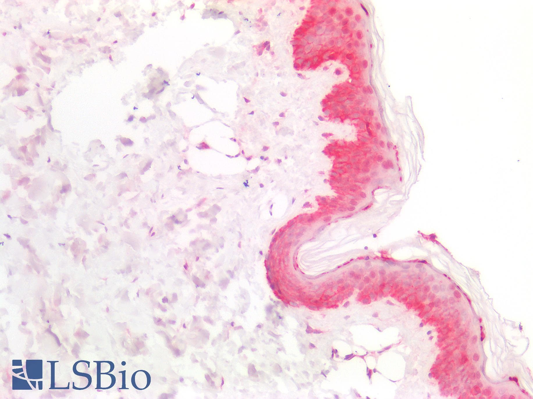 PathPlus™ NDRG1 Antibody