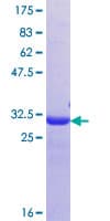 Human OSCAR Protein (Recombinant GST, N-terminus)