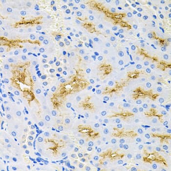 Polyclonal Rabbit anti-Human CASP9 / Caspase 9 Antibody (IHC, IF, WB)