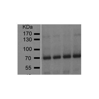 GAD65 Antibody (clone 144)