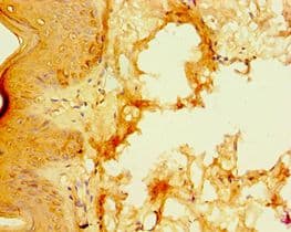 S100A3 / S100E Antibody (aa1-101)