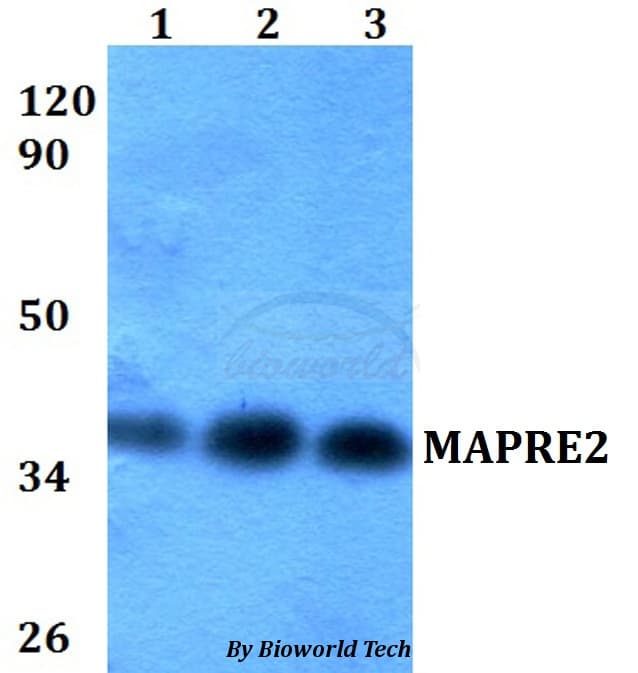 MAPRE2 / EB2 Antibody