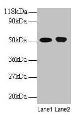 IHC-plus™ ODC1 / Ornithine Decarboxylase Antibody