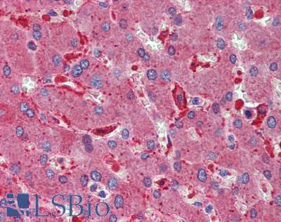 Polyclonal Rabbit anti-Human AADAC Antibody (IHC)