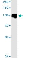 Monoclonal Mouse anti-Human MARK2 Antibody (clone 3B12, WB)