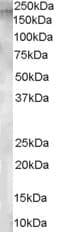 IHC-plus™ ENPEP / Aminopeptidase A Antibody (aa805-818)