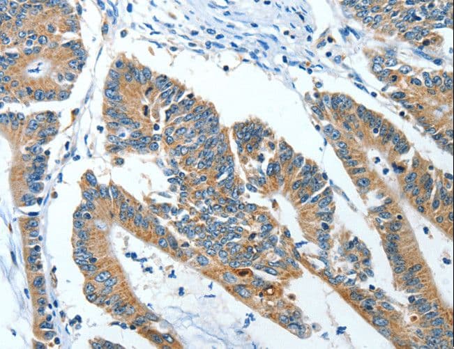 ANGPT1 / Angiopoietin-1 Antibody