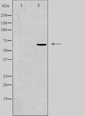 DDX52 Antibody