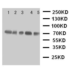 NRG1 / Heregulin / Neuregulin Antibody (aa617-636)