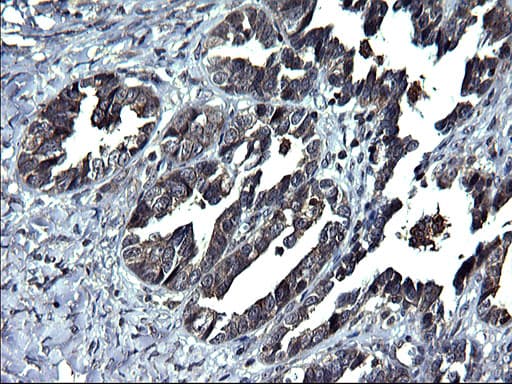 ANKMY2 Antibody (clone OTI1F11)