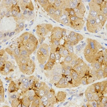 Polyclonal Rabbit anti-Human LHB / Luteinizing Hormone Antibody (IHC, WB)