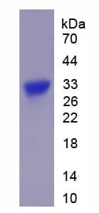 Mouse CTNNB1 / Beta Catenin Protein (Recombinant His)